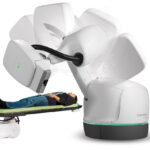 Doctors At Apollo Cancer Centre, Bengaluru End Woman’s 25-Year Struggle With Rare “Laughing Seizures” Using Advanced Technology.