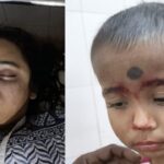Tragic Incidents At Dharmanagar Rath Yatra: 19-Year-Old Trisha Bhowmik Dies Suddenly, Child Injured After Chariot Spire Collapses.