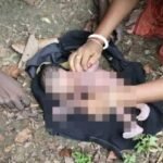 Newborn Rescued From Jungle After Being Attacked By Ants And Insects.
